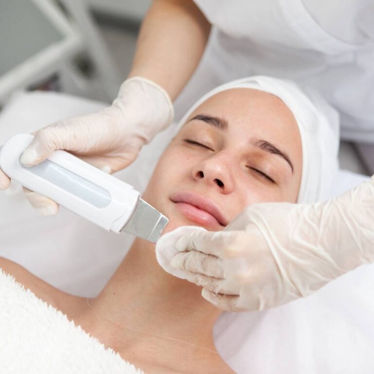 Peeling kawitacyjny